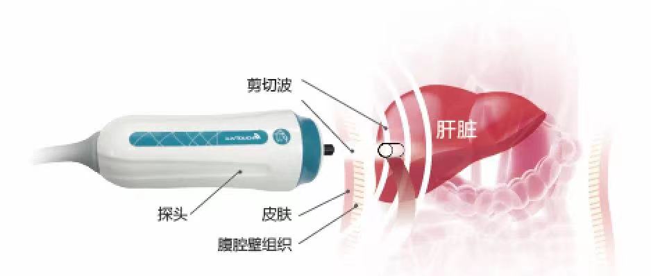 2021全國雙創周開幕！與總理連線對話，海斯凱爾靠什么讓總理點贊？